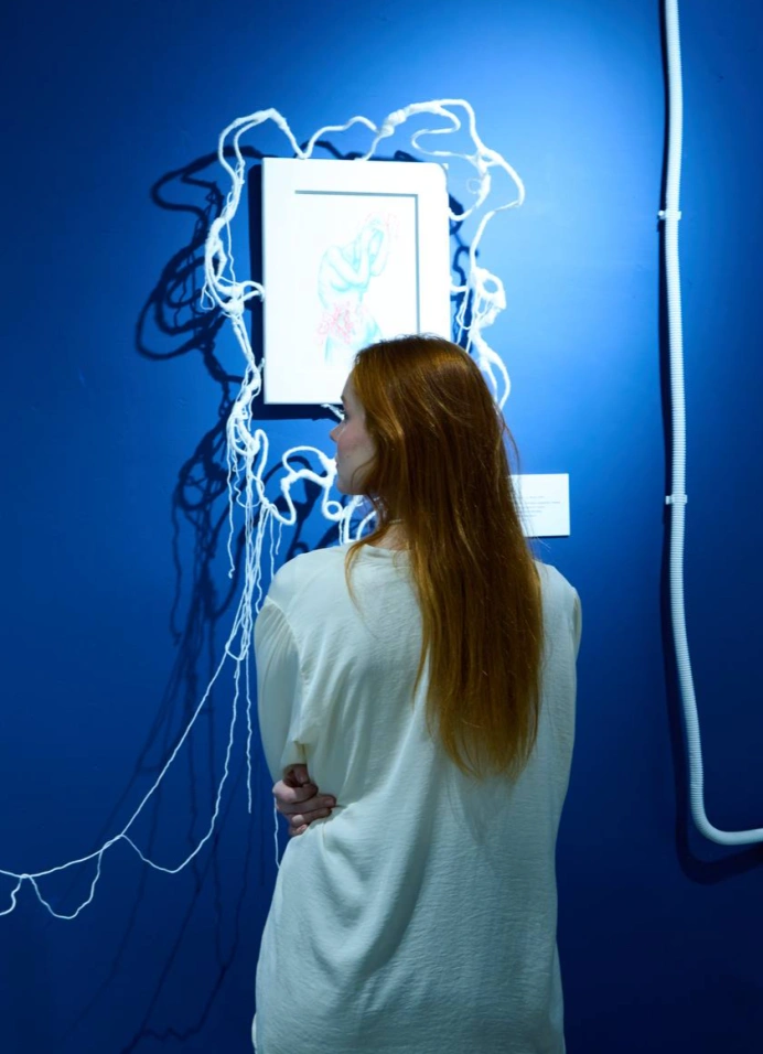 Оцепенение